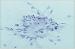 Abb. 8: Smear