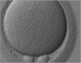 Abb. 1: Diploide Rieseneizelle