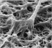 Abb. 9: Spermatozoon - Zona pellucida