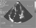 Abb. 10: Echokardiographie