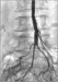 Abb. 5: Abschlußarteriographie