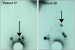 Abb. 1: Pelvine Lymphszintigramme