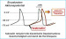 Aktuelles Bild - Abb. 2: If-Kanal