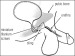 Abb. 5: In-Vance-System