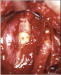 Abb. 2c: Arteria carotis communis