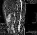 Aktuelles Bild - Abb. 8: MRI - LWS