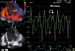 Aktuelles Bild - Abb. 16: Gewebedoppler (