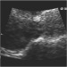 Abb. 4: Transthorakales Echo