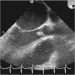 Aktuelles Bild - Abb. 8: Transthorakales Echo