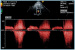 Abb. 8: CW-Doppler