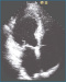 Aktuelles Bild - Abb. 2: Lange Achse