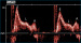 Abb. 3: Gepulster Doppler - Mitraldoppler