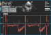 Abb. 6: Gepulster Doppler - LVOT