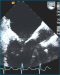 Abb. 10: Aorta ascendens