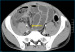 Aktuelles Bild - Abb. 4: Ileum