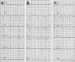 Aktuelles Bild - Abb. 2: EKG