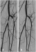 Abb. 1: Claudicatio intermittens