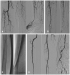 Abb. 5: Diabetes mellitus - Ischämie