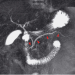 Abb. 1b: Ductus pancreaticus