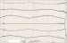 Aktuelles Bild - Abb. 2: EKG