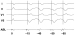 Aktuelles Bild - Abb. 4: EKG
