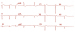 Abb. 4: EKG