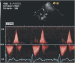 Aktuelles Bild - Abb. 4: Pulmonalarterie