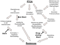 Abbildung 1: Restenose - Angioplastie