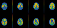 Abbildung 2: Serotonin 5-HT