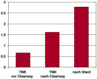 Abbildung 5: TIMI-Fluss