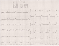Abbildung 2: EKG
