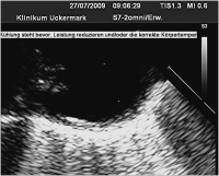 Abbildung 2: Aorta thoracalis