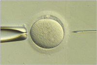 Abbildung 9: ICSI