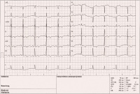 Abbildung 2: EKG