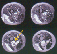 Abbildung 2: MR-Angiographie