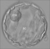 Abbildung 1: Blastocyst - Hatching