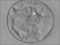 Abbildung 3: Blastocyst