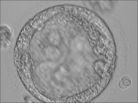 Abbildung 6: Trophoblast vesicle