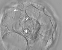 Abbildung 5: Inner cell mass
