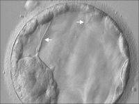 Abbildung 7: Blastocyst