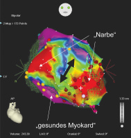 Abbildung 2: Substrat Mapping