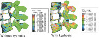 Abbildung 6: Kyphosis