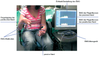 Abbildung 1: EMG