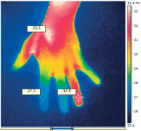 Abbildung 4: Thermographische Aufnahme