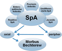 Abbildung 1: Beziehung zwischen Spondyloarthritis und Morbus Bechterew
