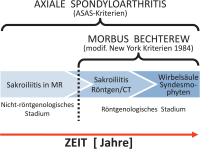 Abbildung 2: Stadieneinteilung Spondyloarthritis
