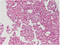 Abbildung 5: Histologischer Schnitt eines Stanzzylinders