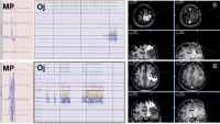 Figure 2a-b: DTI-FT