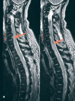 Figure 2-a: MRI