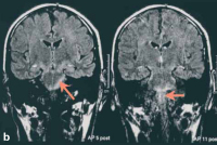 Figure 2-b: MRI